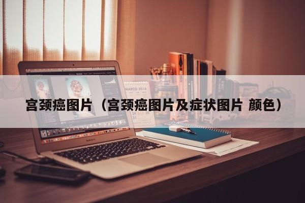 宫颈癌图片(宫颈癌图片及症状图片 颜色)